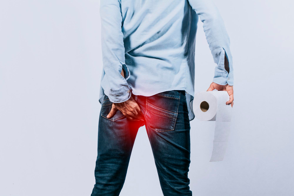 hemorrhoids